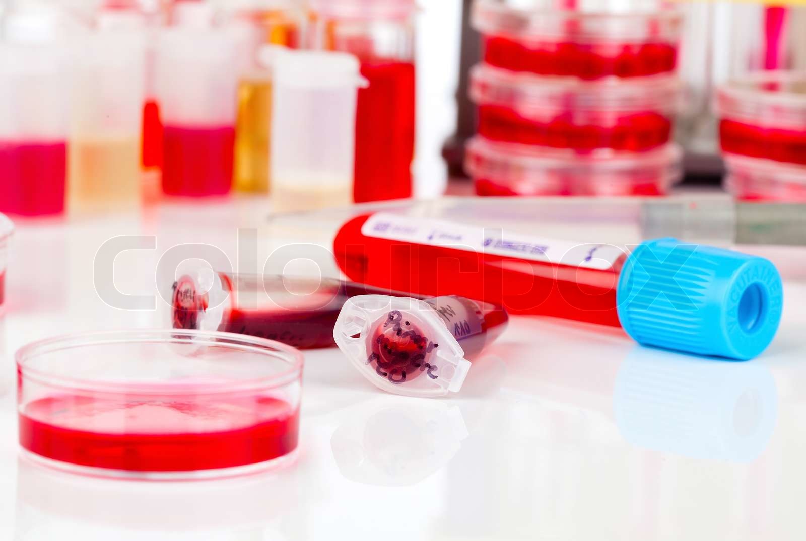 Blutprobe im Reagenzglas | Stock Bild | Colourbox