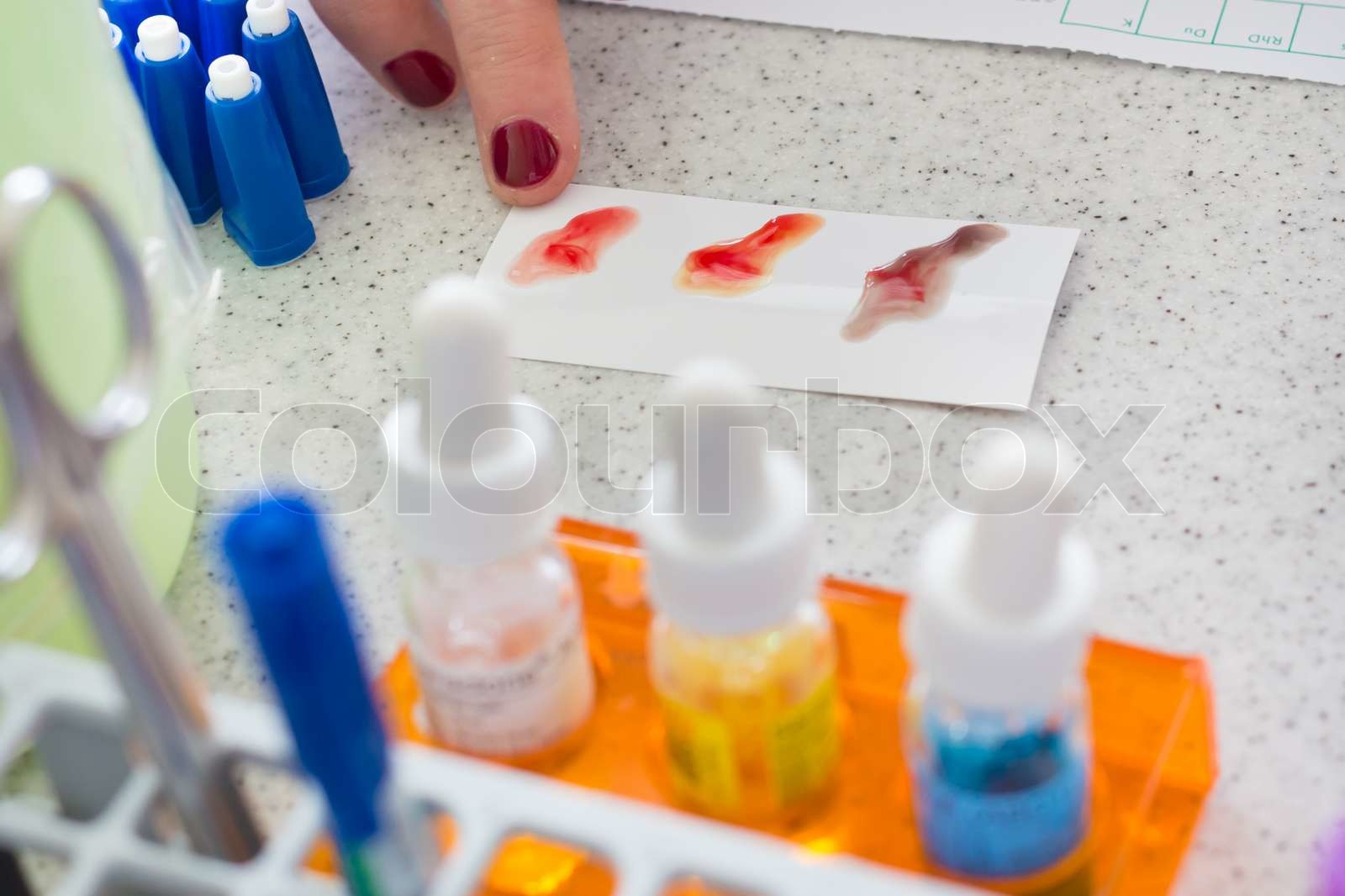 Blood type testing. Stock image Colourbox