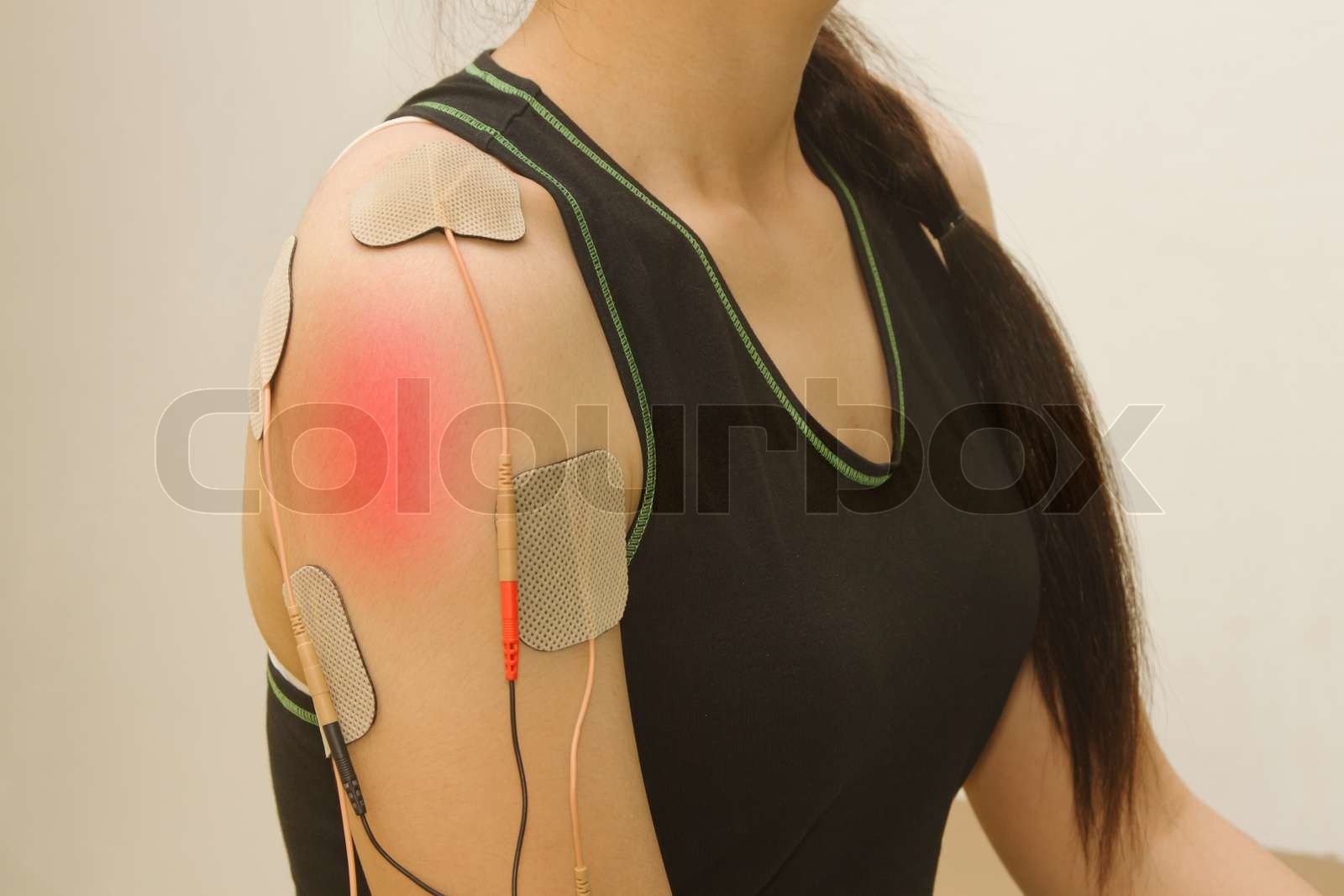 Electrodes device on shoulder, transcutaneous interferential electrical