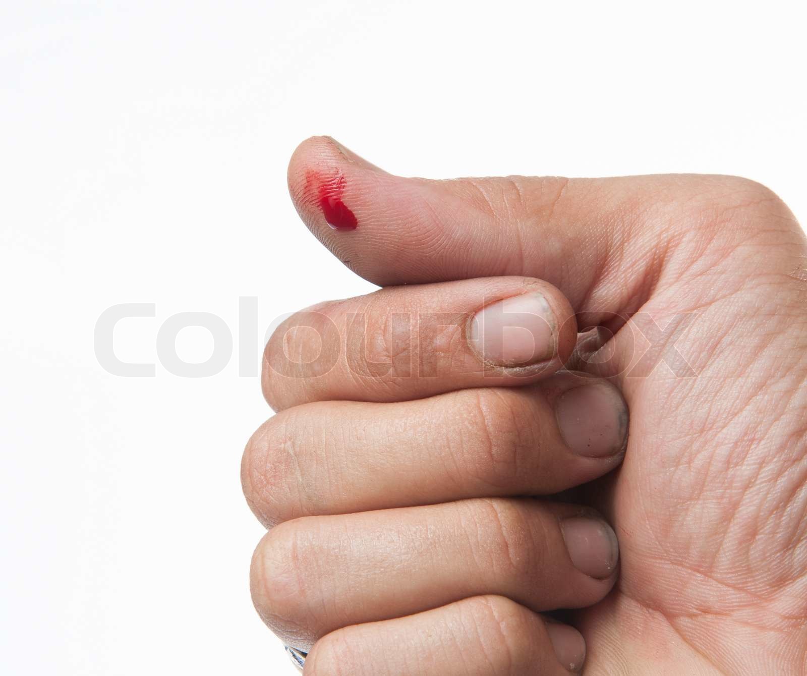 wounded finger with blood dripping isolated on white Stock image Colourbox