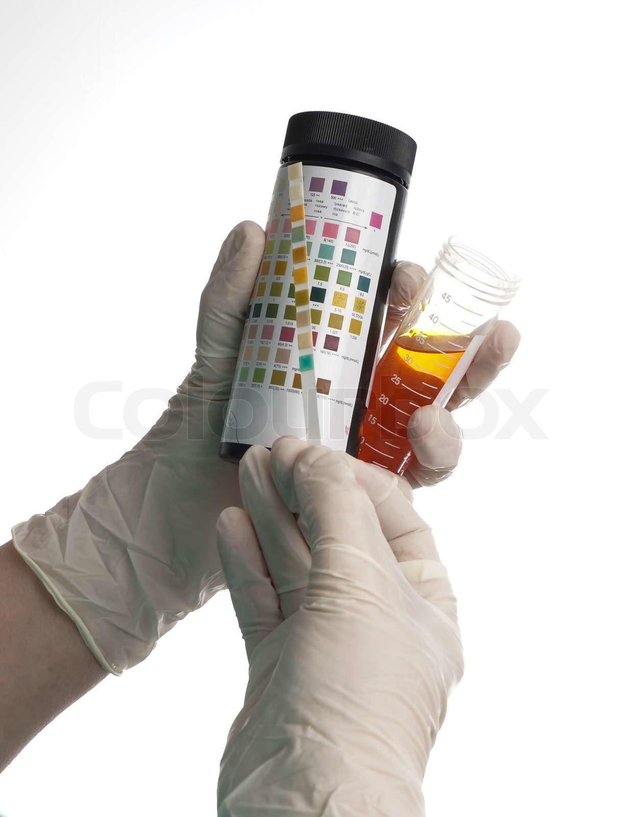 Urine test stripes examined by a nurse Stock image Colourbox