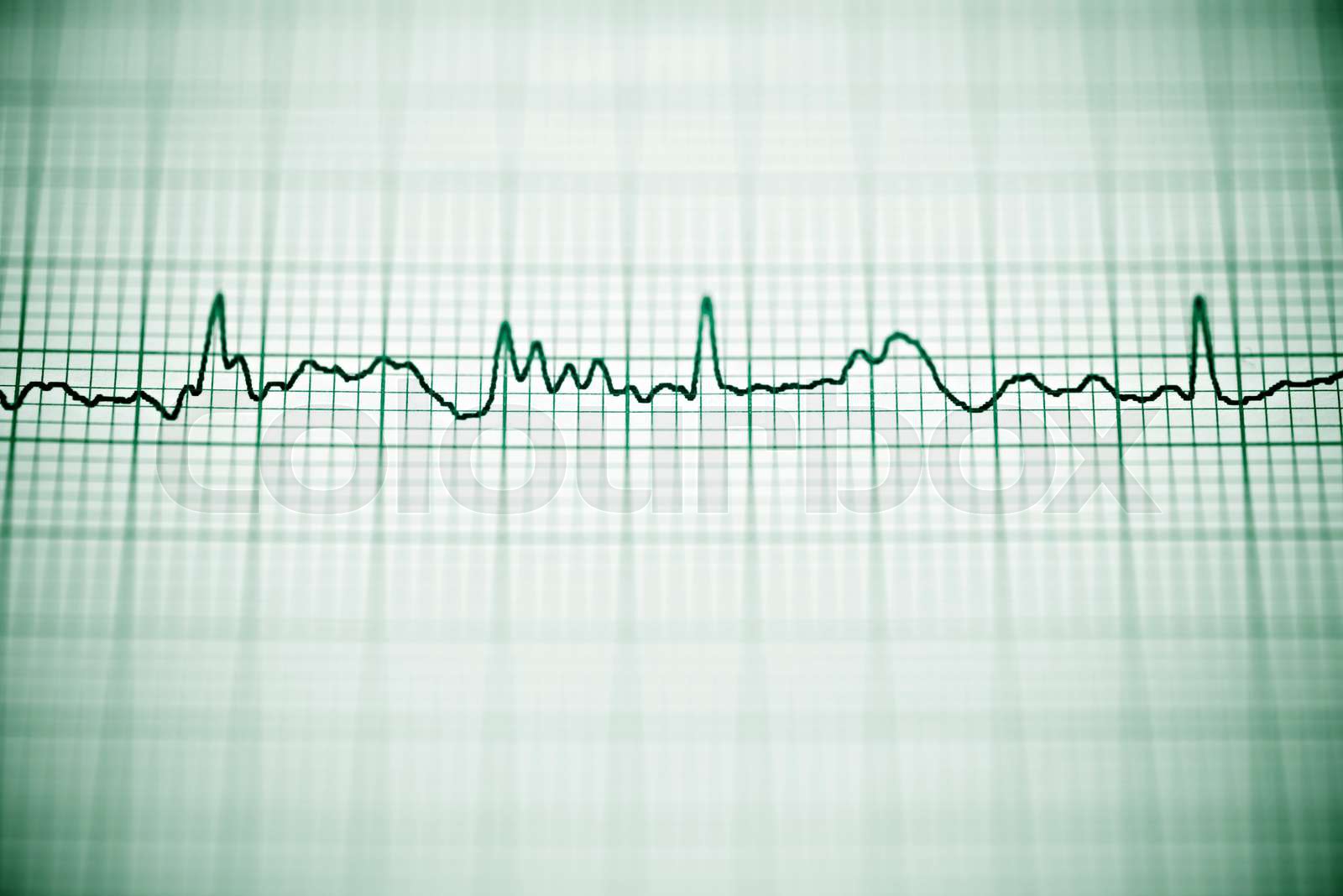 Electrocardiogram Stock image Colourbox
