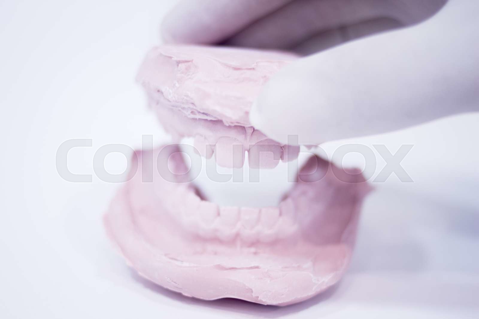 Dental mold dentists clay teeth ceramic plate cast Stock image