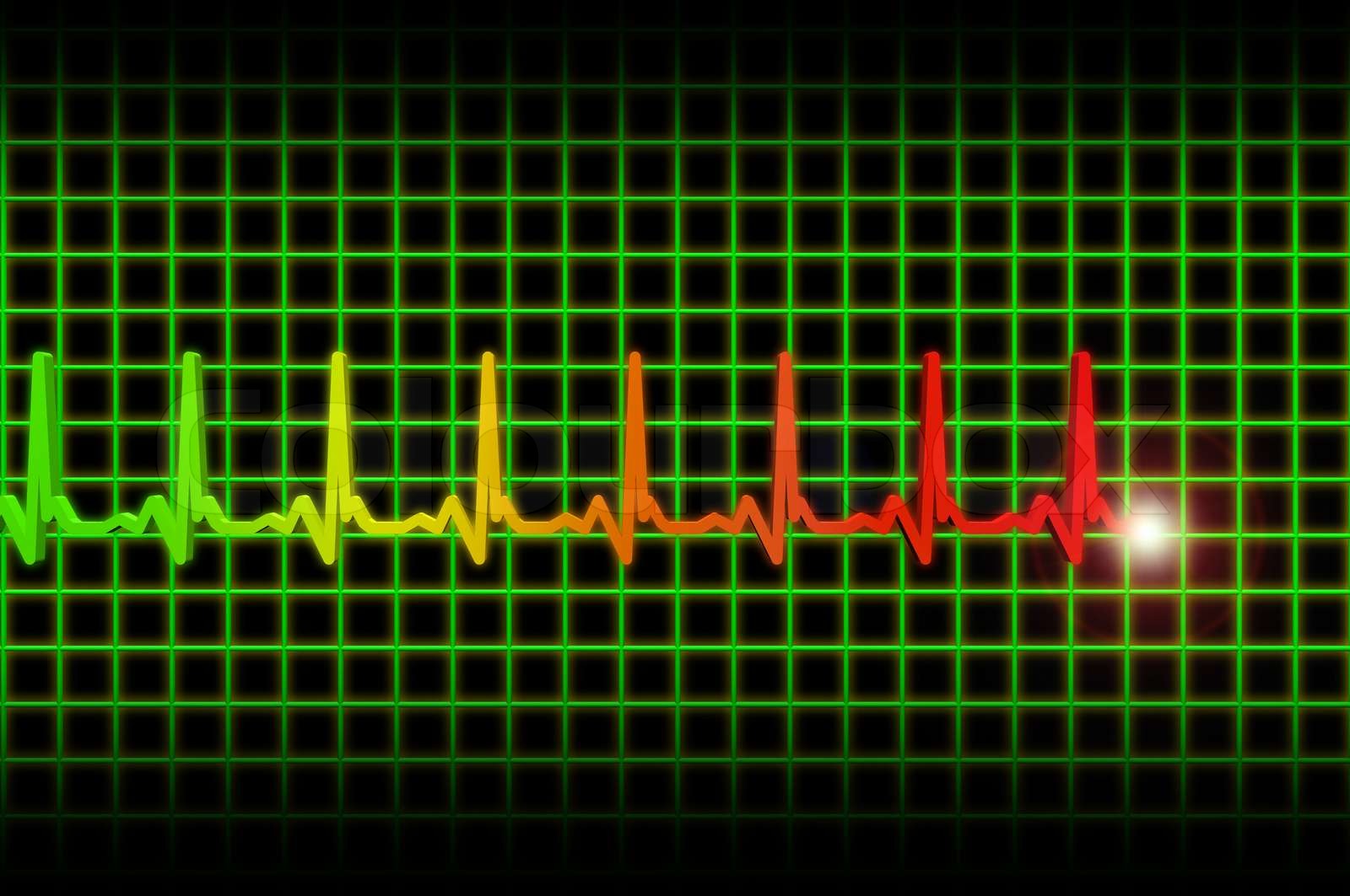 Human hjerterytme ekg / EKG puls header Stock foto Colourbox