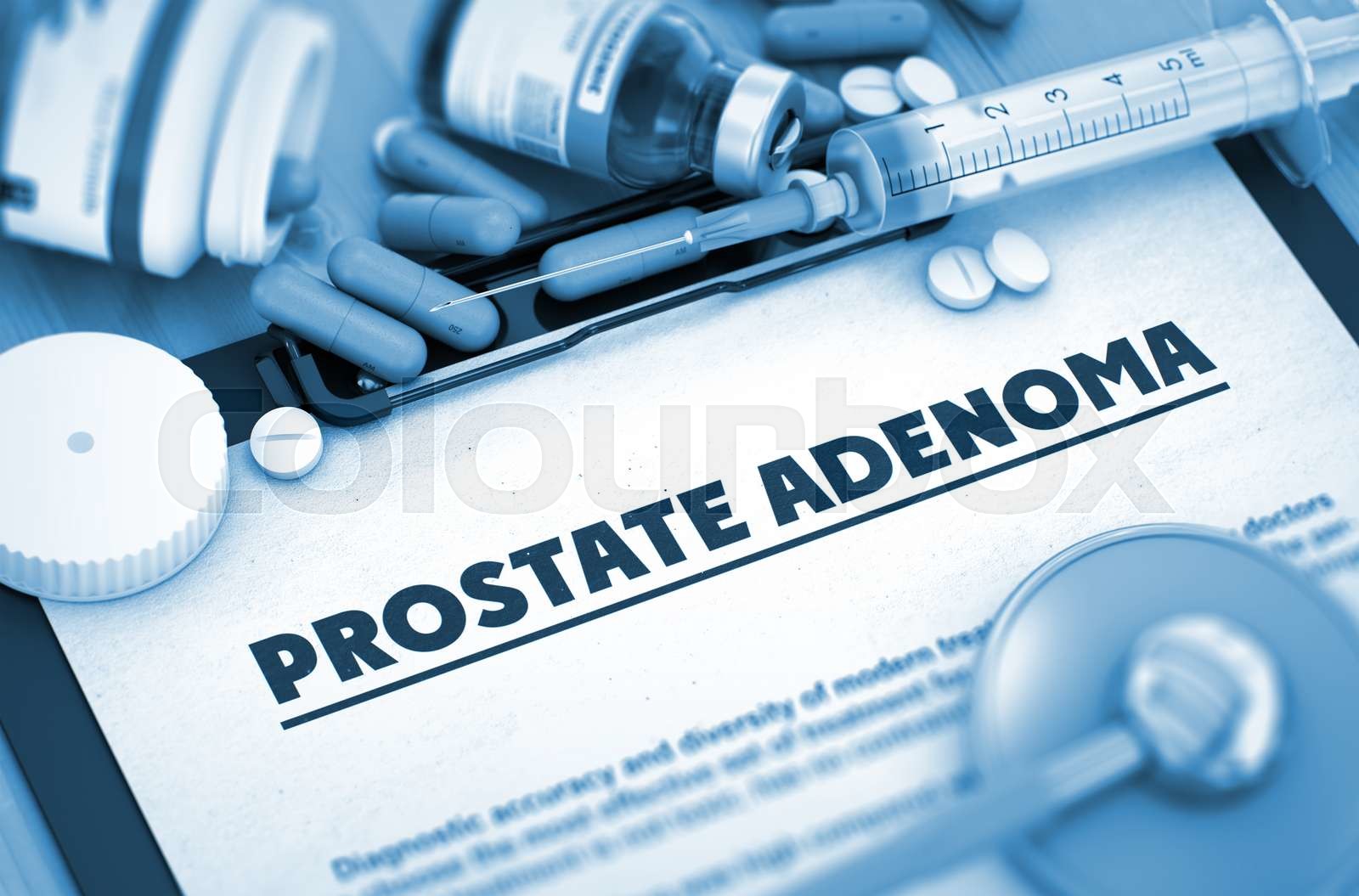 adenoma prostate mkb 10