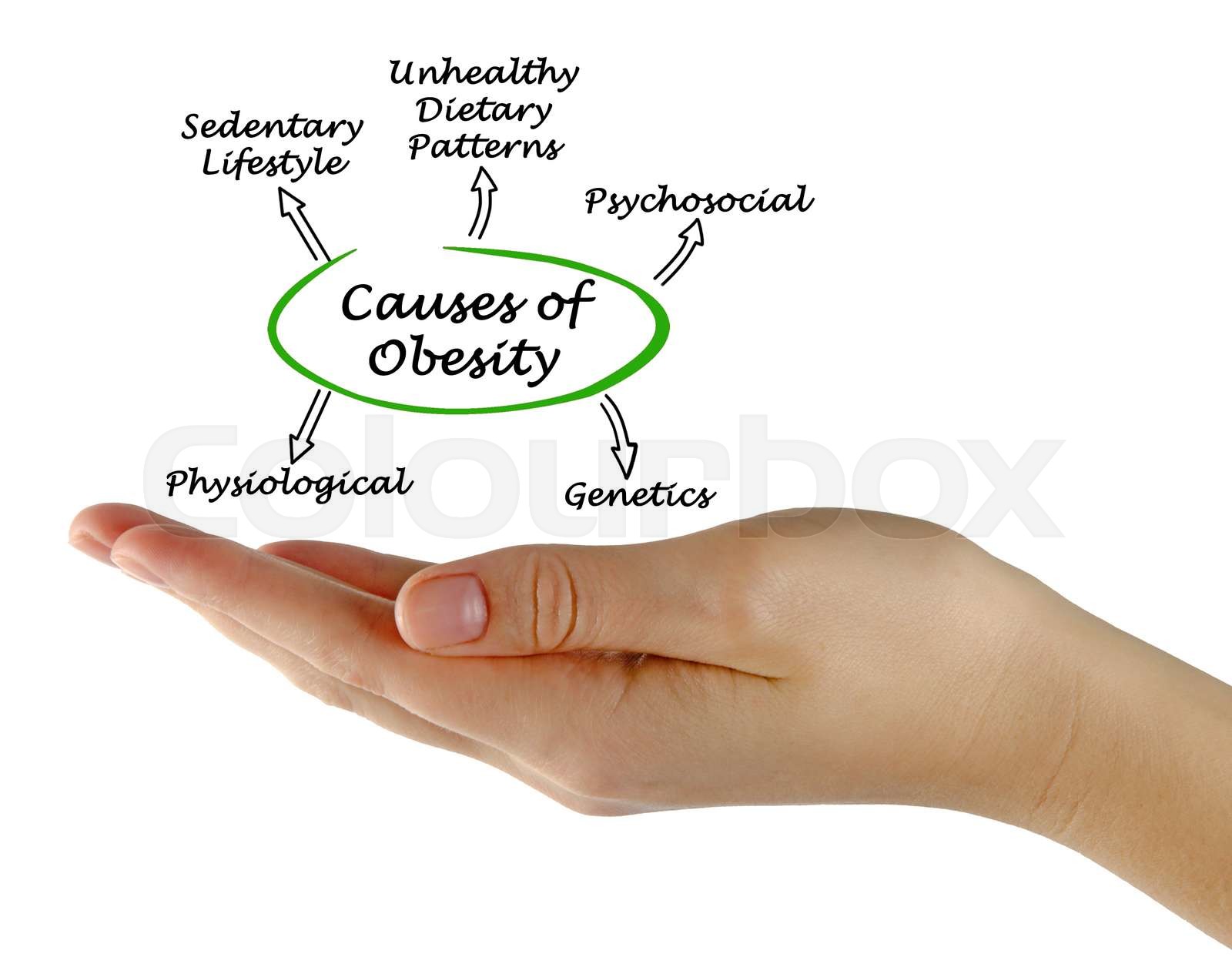 Causes Of Obesity Stock Image Colourbox Causes of obesity stock image colourbox