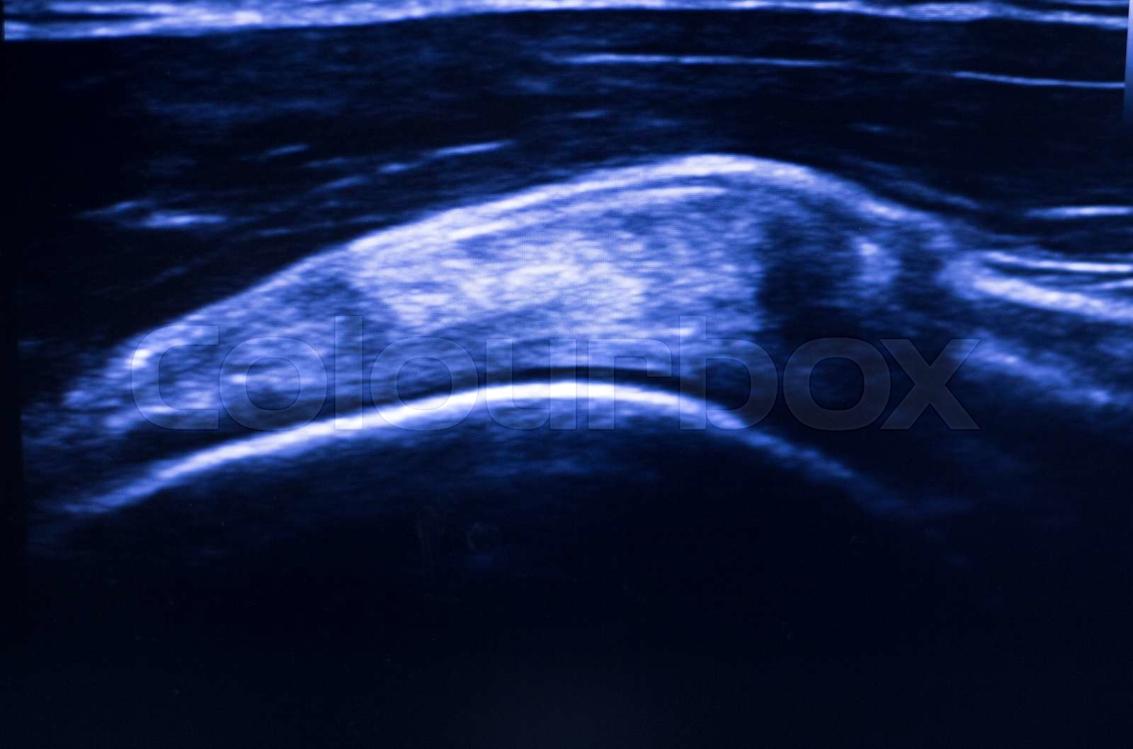 Ultrasound ecograph EPI ecography | Stock image | Colourbox