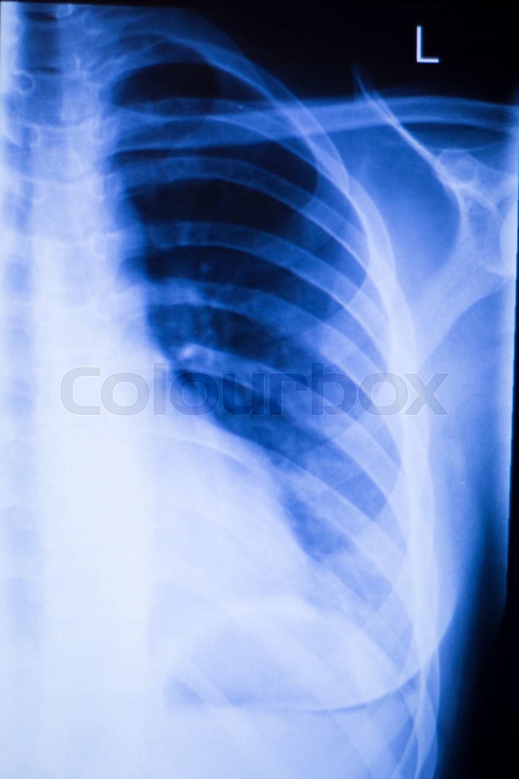 ribben, brud, skulder | Stock foto | Colourbox