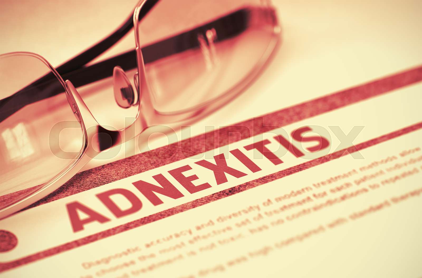 Adnexitis. Medicine. 3D Illustration. | Stock image | Colourbox