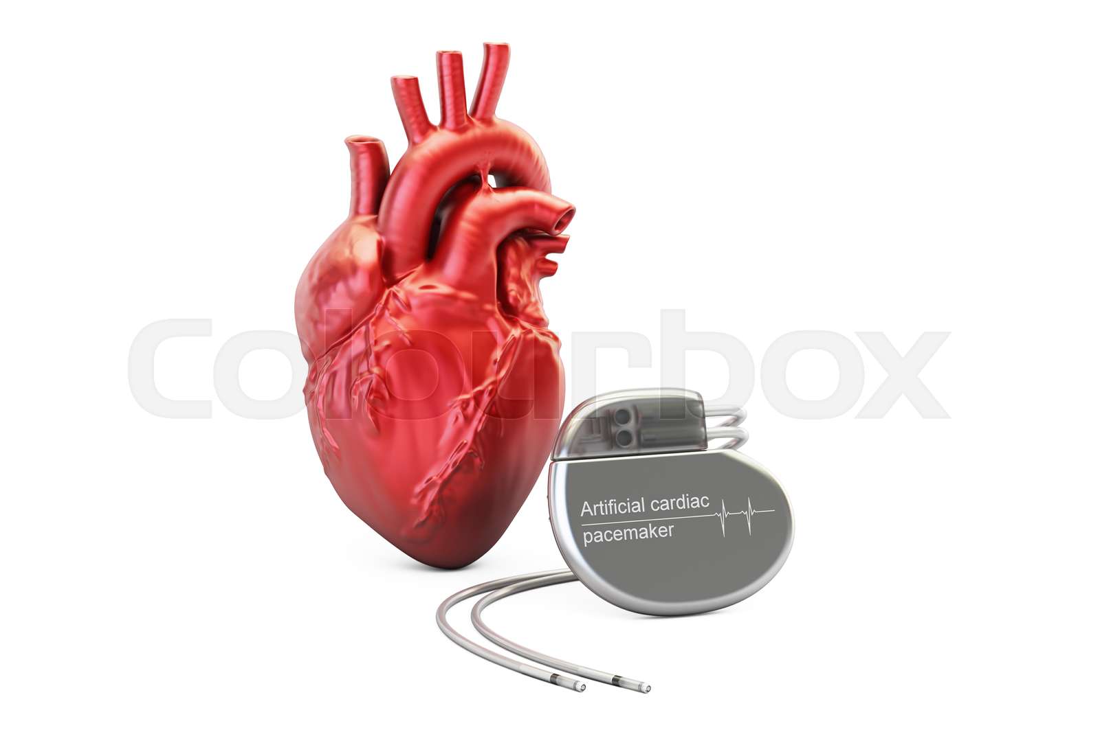 Artificial cardiac pacemaker, 3D rendering | Stock image | Colourbox