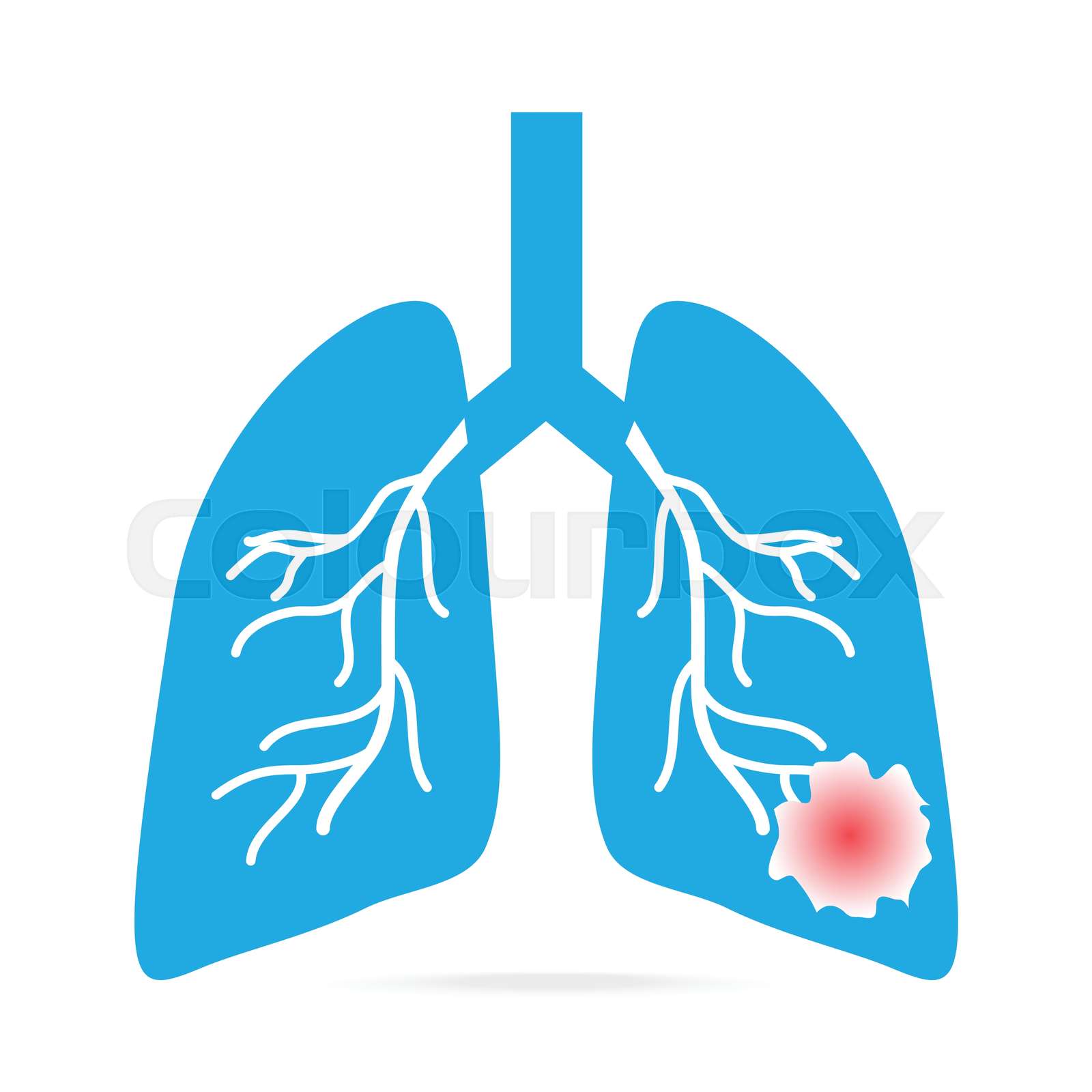 lung cancer blue icon, medical concept illustration | Stock vector