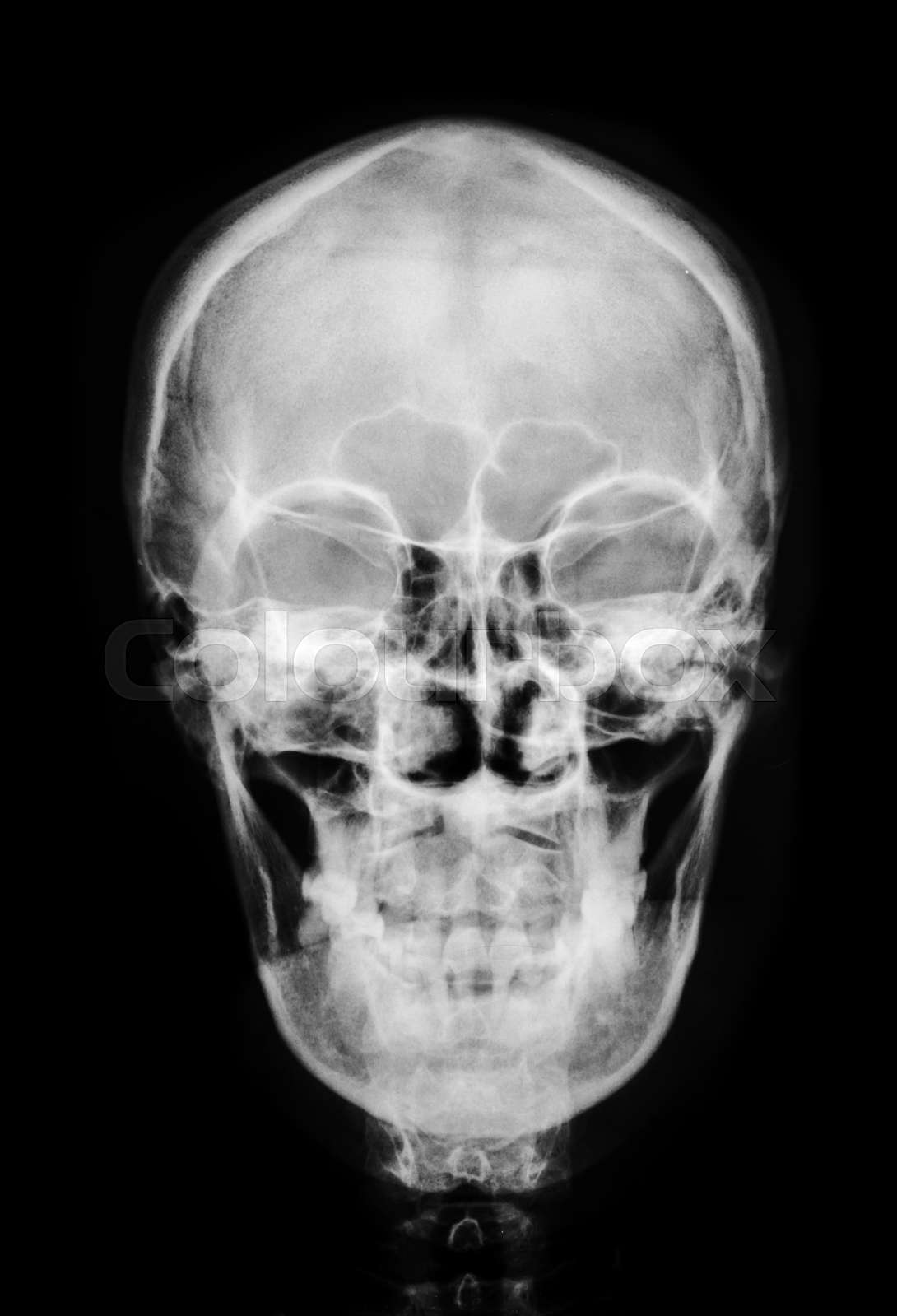 front face skull xray. Stock image Colourbox