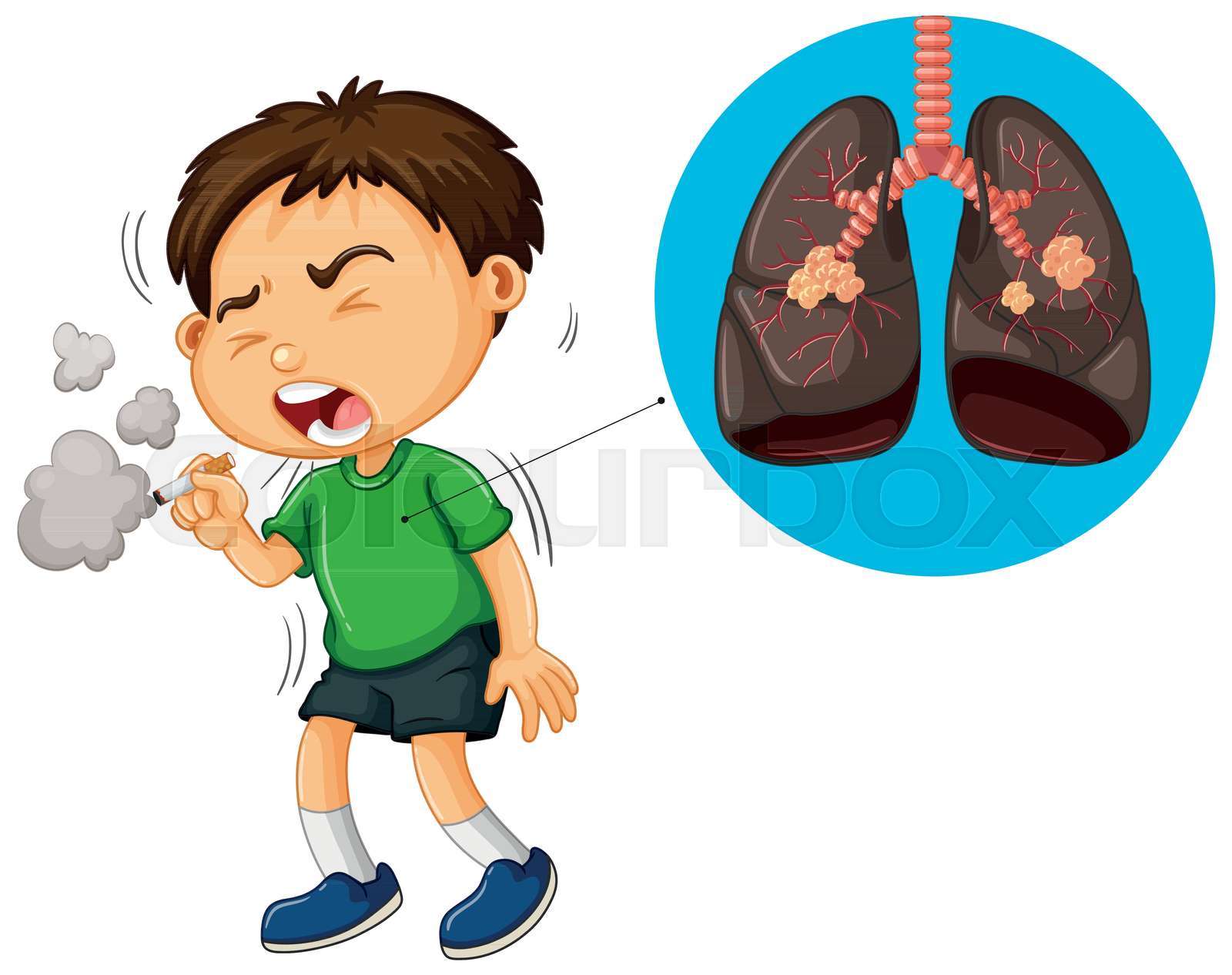 Boy smoking cigarette and unhealthy lungs diagram Stock vector