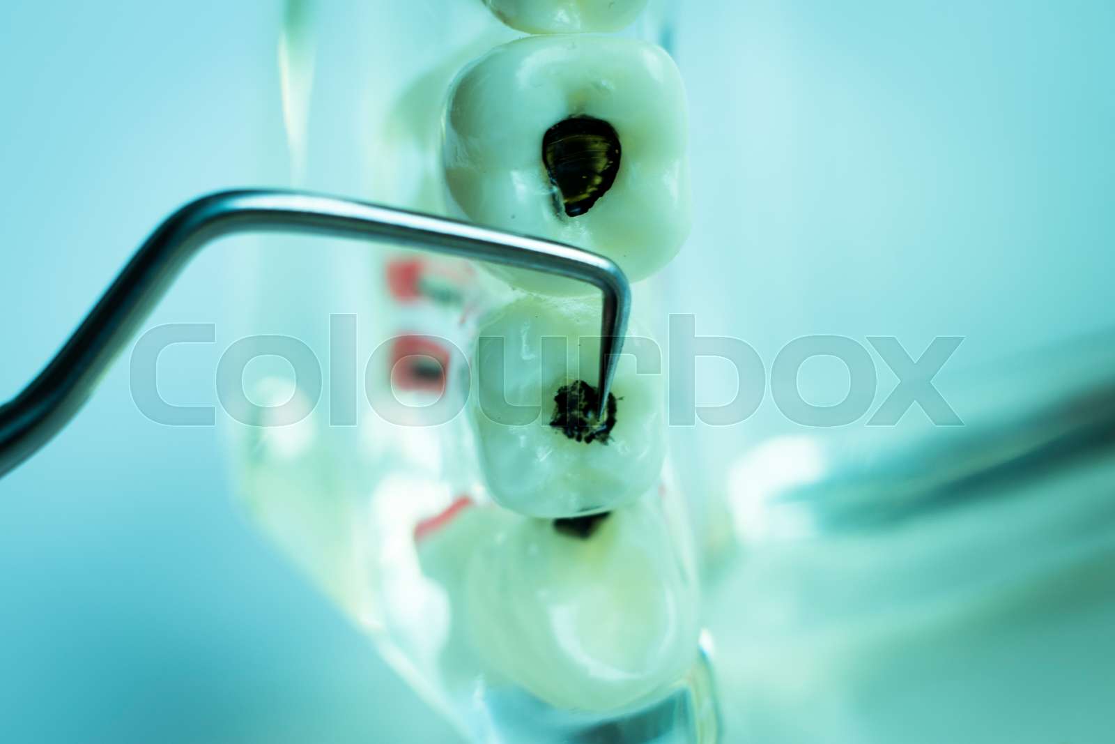 Dentist cleaning teeth Stock image Colourbox