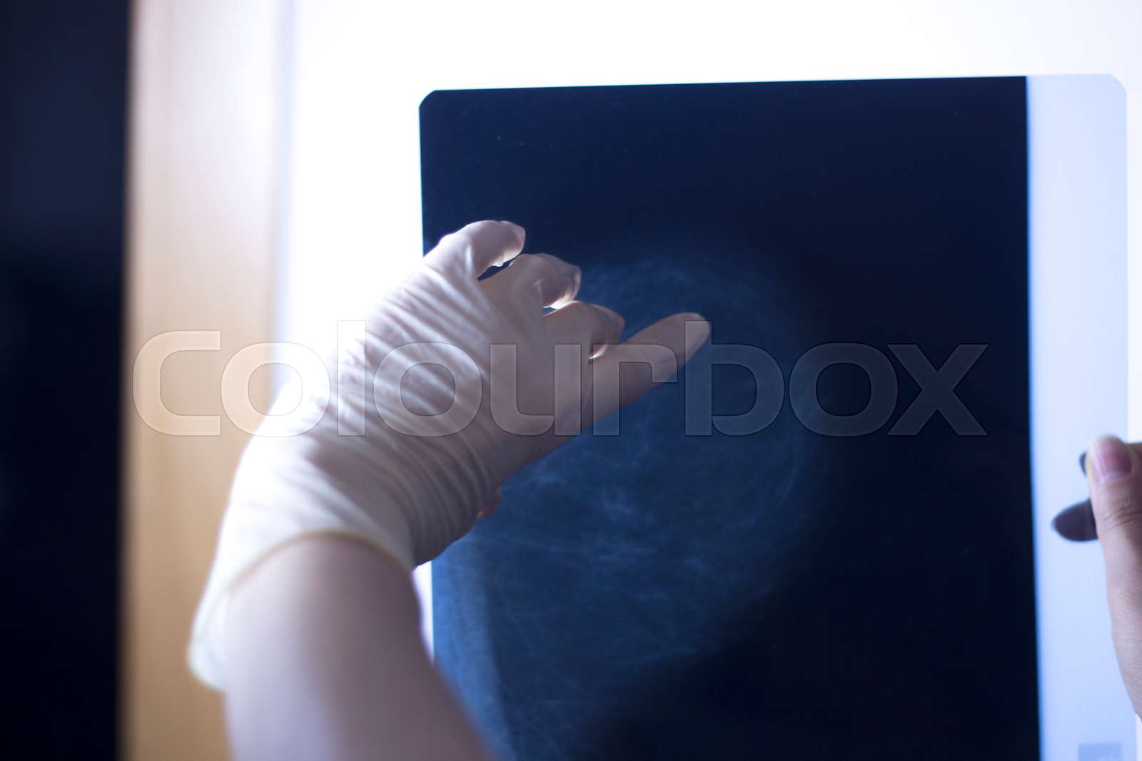 Xray breast scan mammogram | Stock image | Colourbox