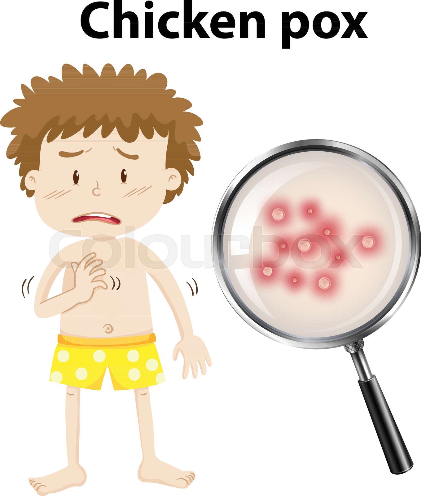 Is Your Dog Safe? Understanding Canine Chicken Pox Risk - 0o6djw9