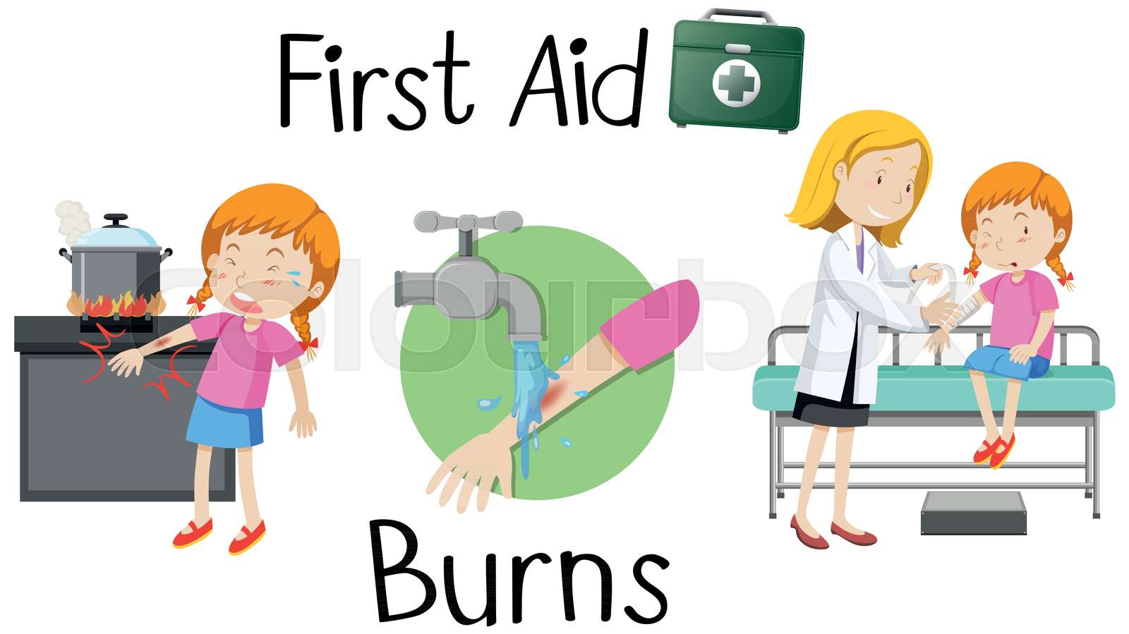 A girl with burn arm first aid Stock vector Colourbox