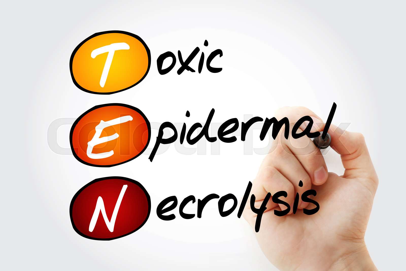 TEN - Toxic Epidermal Necrolysis, acronym | Stock image | Colourbox