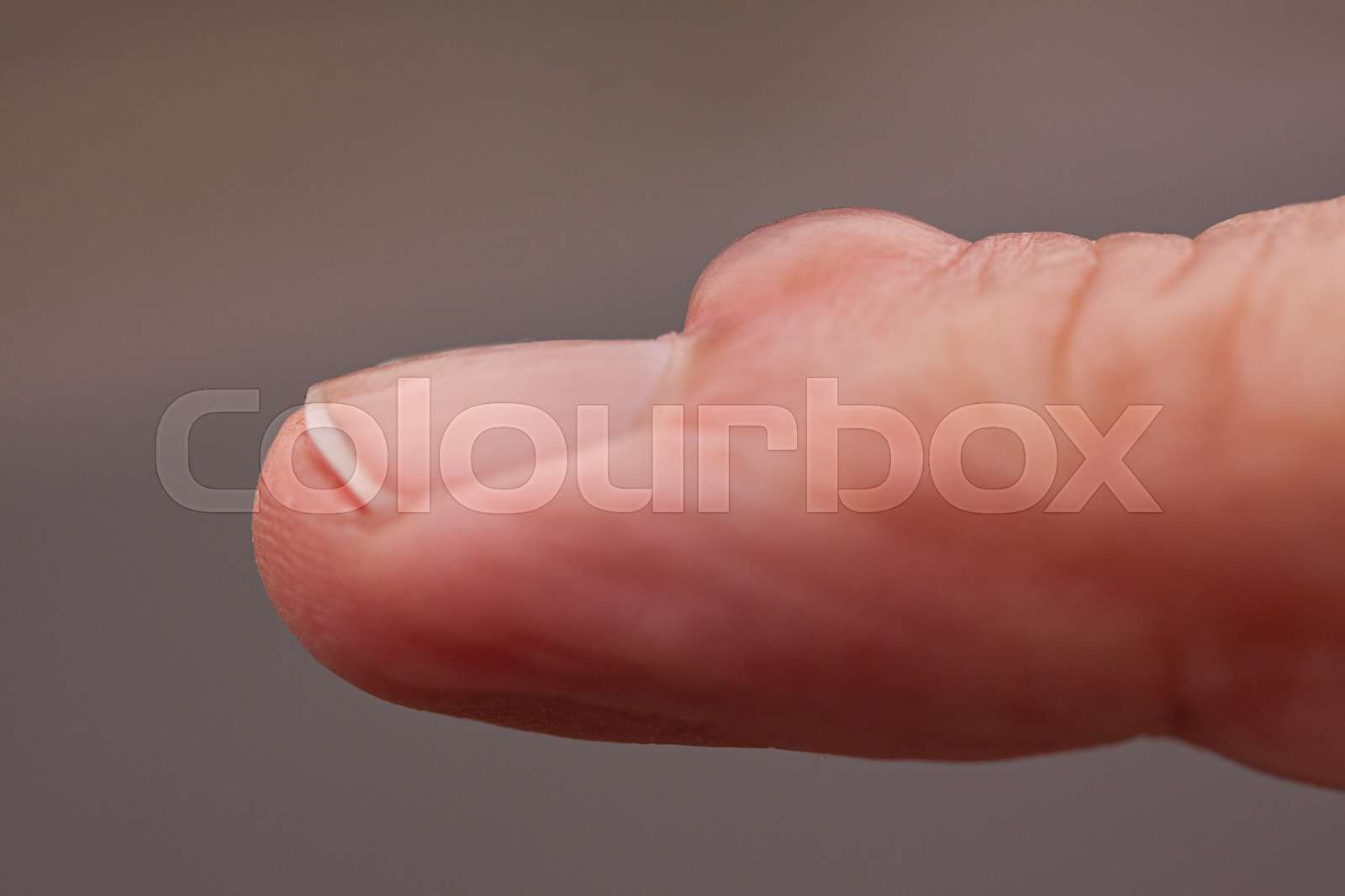 Bump On Thumb Nail Reddit