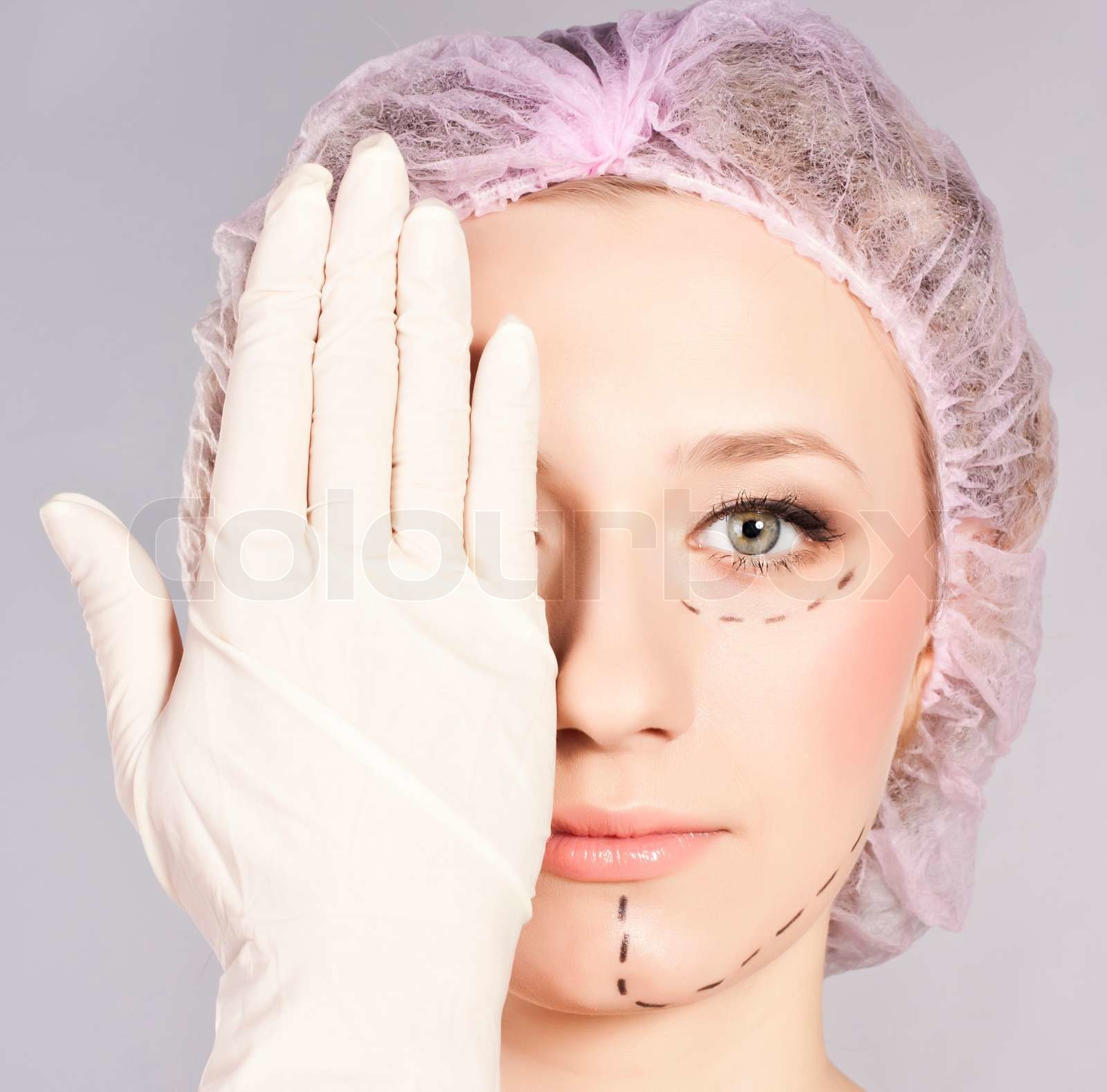 Lines onlady face, as marks for cosmetic plastic surgery | Stock image