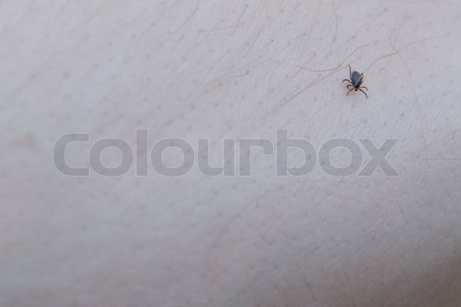 Tick walking on skin Stock image Colourbox