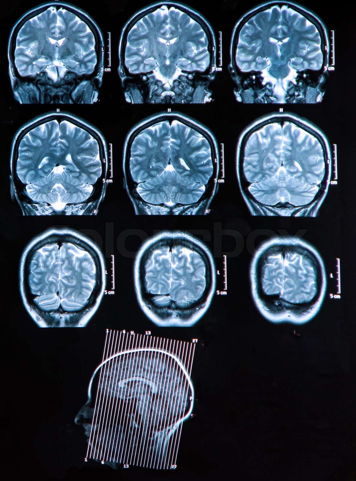 MRI Gehirn-scan | Stock Bild | Colourbox