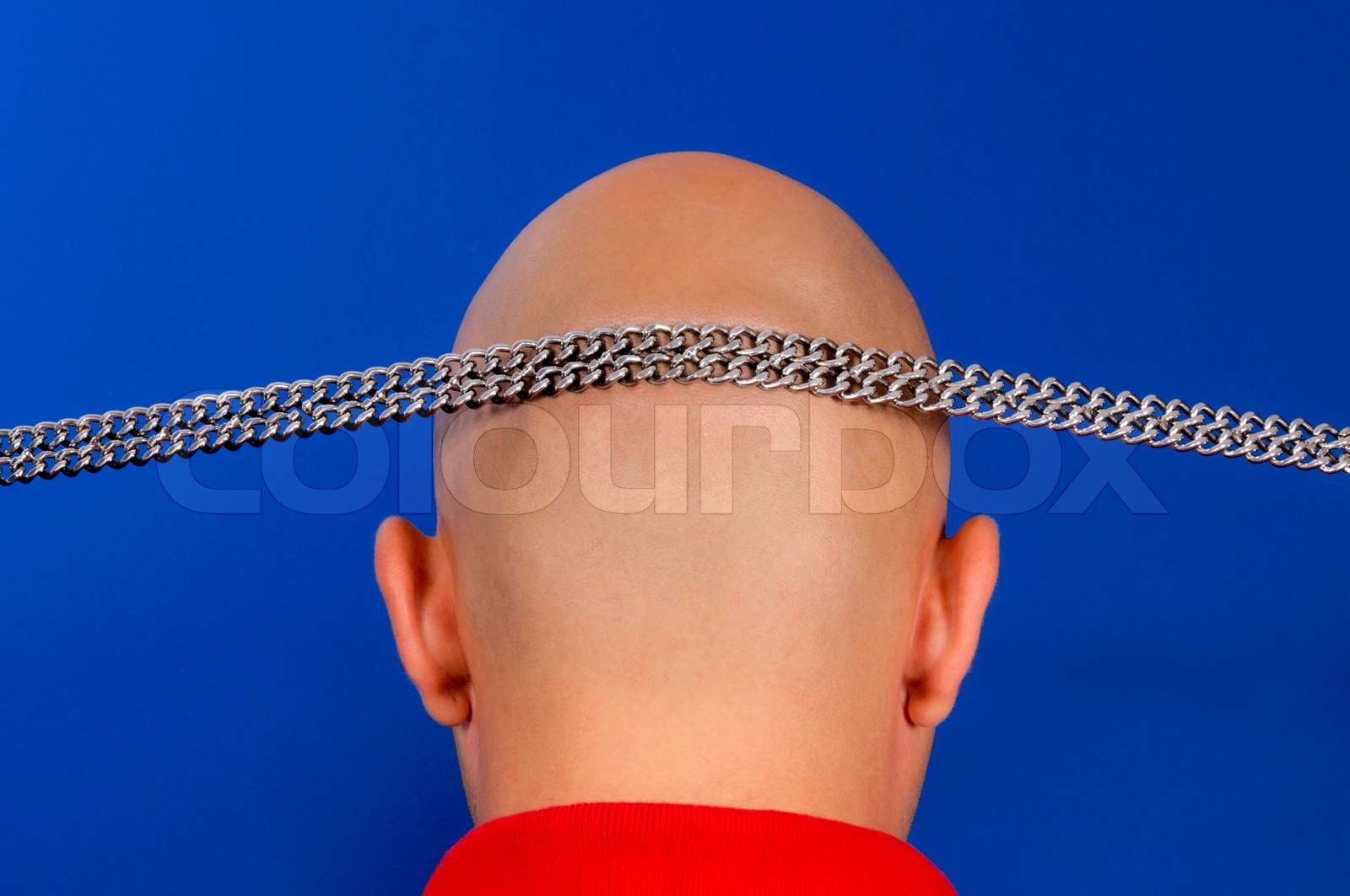 Baldness Problem Stock Image Colourbox