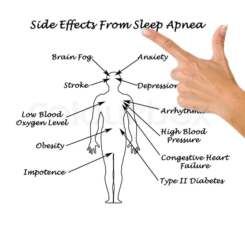 an introduction to the issue of sleep apnea in todays society Introduction obstructive sleep apnea syndrome (osas) is a common condition in childhood and can result in severe complications if left untreated. an introduction to the issue of sleep apnea in todays society Introduction obstructive sleep apnea syndrome (osas) is a common condition in childhood and can result in severe complications if left untreated.