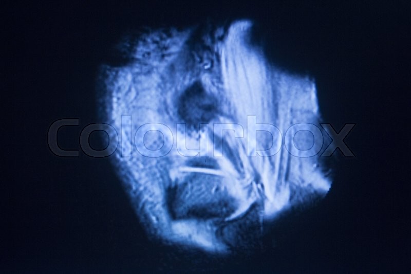 Körper, resonanz, bild Stockfoto Colourbox