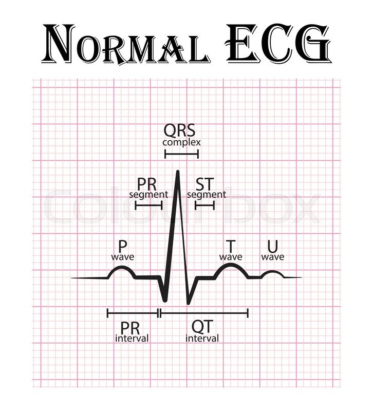 Ecg Chart Normal