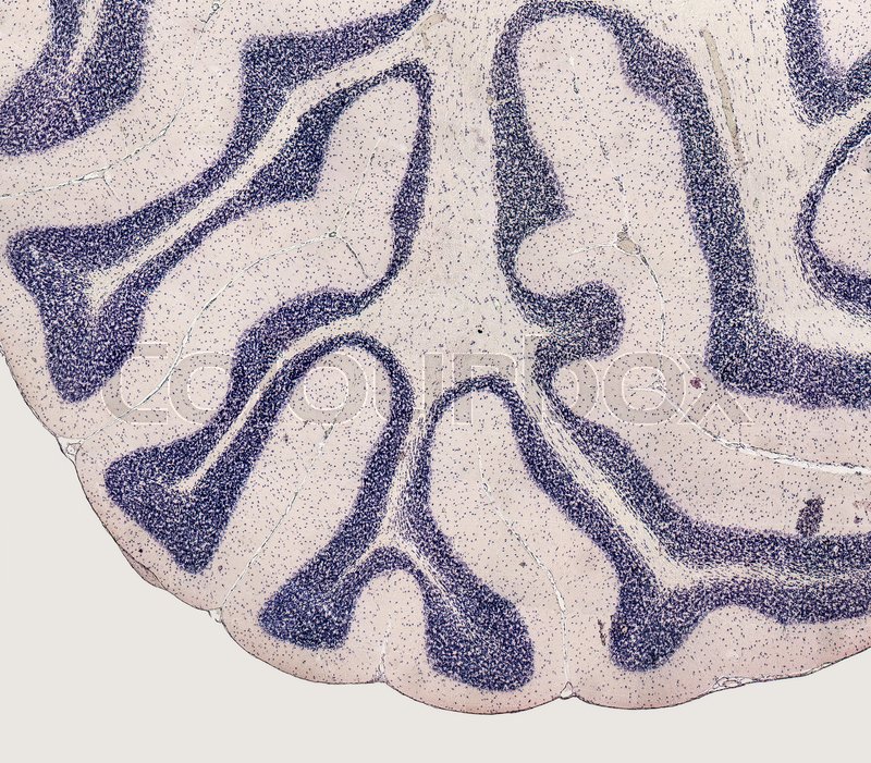 Microscopic detail showing the brain of ... | Stock image | Colourbox