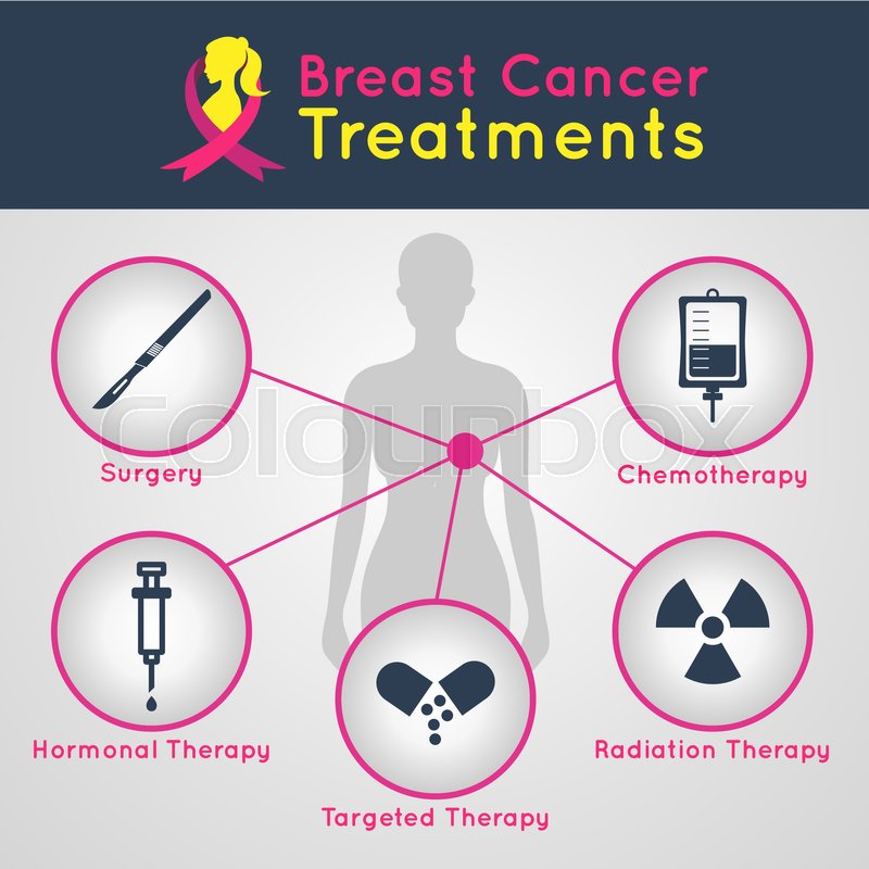 breast cancer and treatments Stripper license in san diego