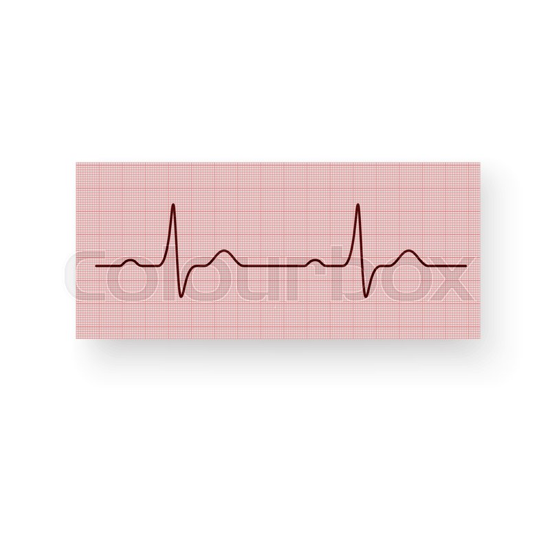 heart rate or a heartbeat on a plotting paper cardiogram of the