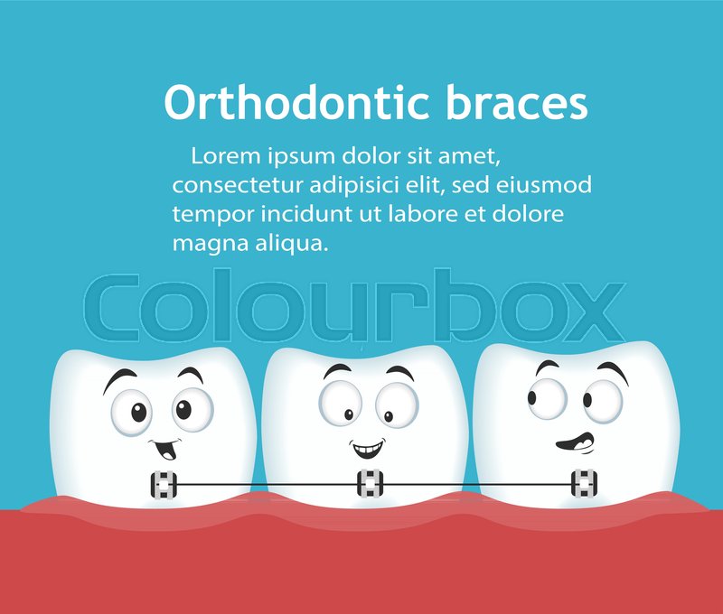 Orthodontic Braces Banner With Teeth Stock Vector Colourbox