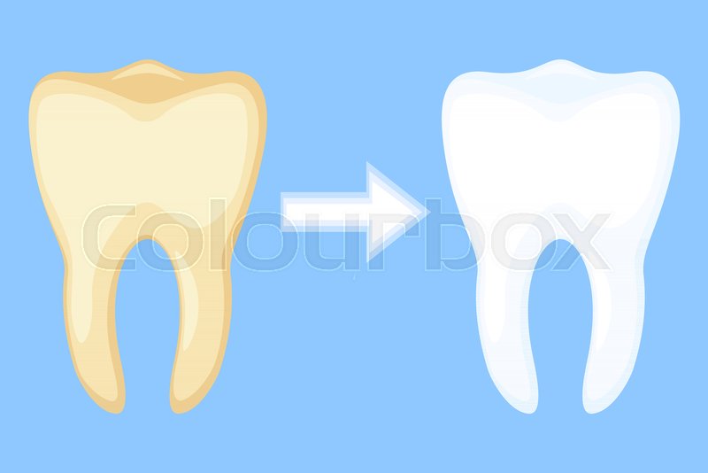 Teeth Whitening Concept Before And Stock Vector Colourbox