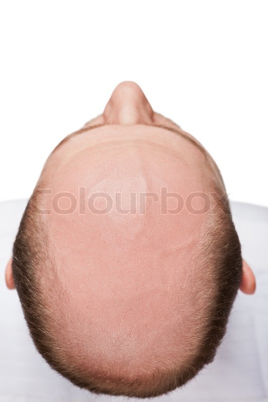 Bald man head  Stock Photo  Colourbox