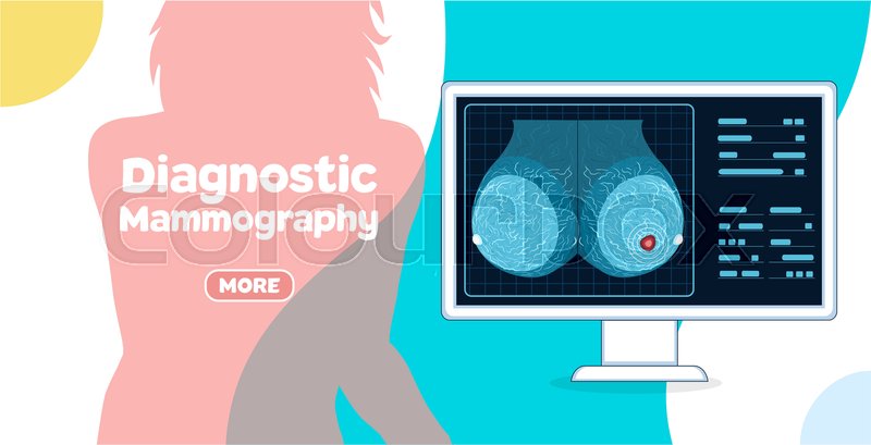Diagnostic Mammography Banner Female Stock Vector Colourbox