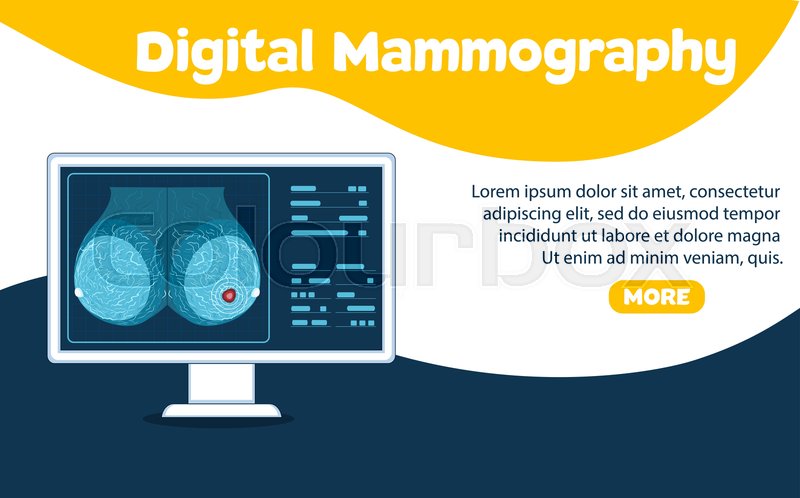 Digital Mammography Banner Female Stock Vector Colourbox