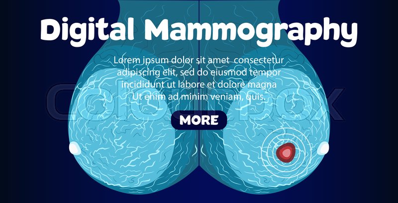 Digital Mammography Banner Female Stock Vector Colourbox
