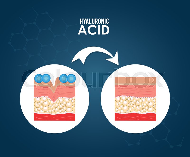 Hyaluronic Acid Infographic ubicaciondepersonas.cdmx.gob.mx