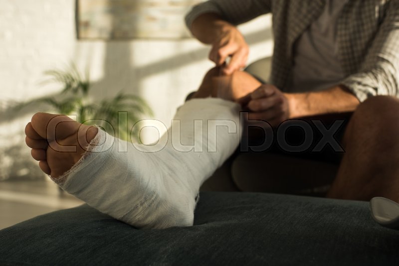 Selective focus of man scratching Stock image Colourbox