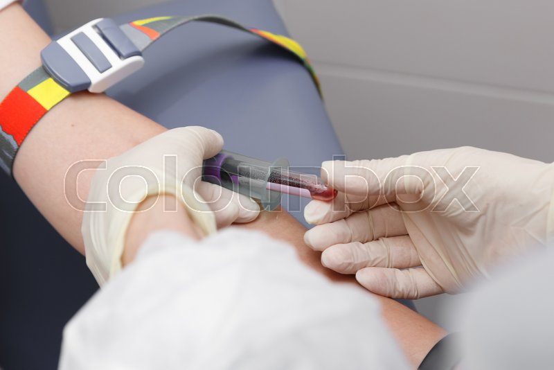 Close up view of blood test procedure Stock image Colourbox