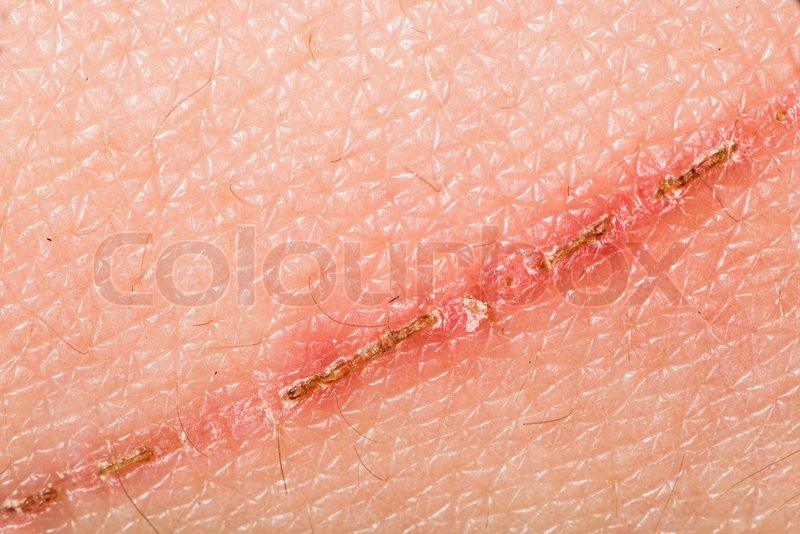 Texture of human skin and scratch. ... | Stock Photo | Colourbox